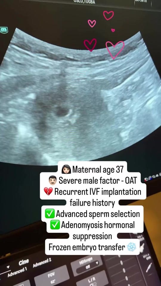 Post 6 by fertilityturkey on TikTok (video)