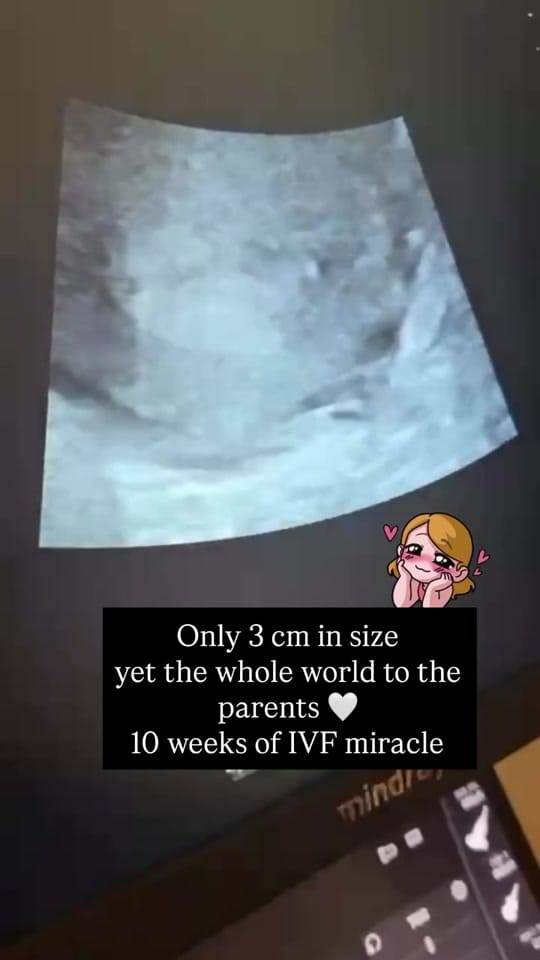 Post 2 by fertilityturkey on TikTok (video)