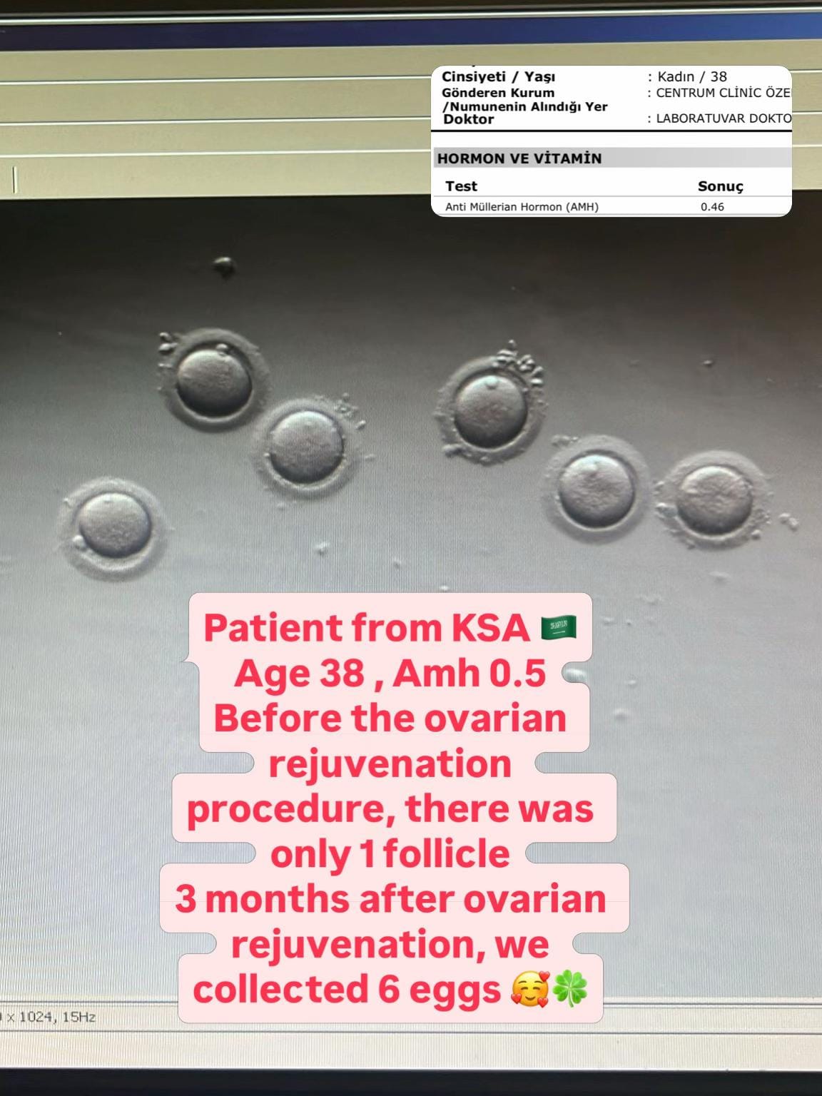 Post 4 by fertilityturkey on TikTok (video)
