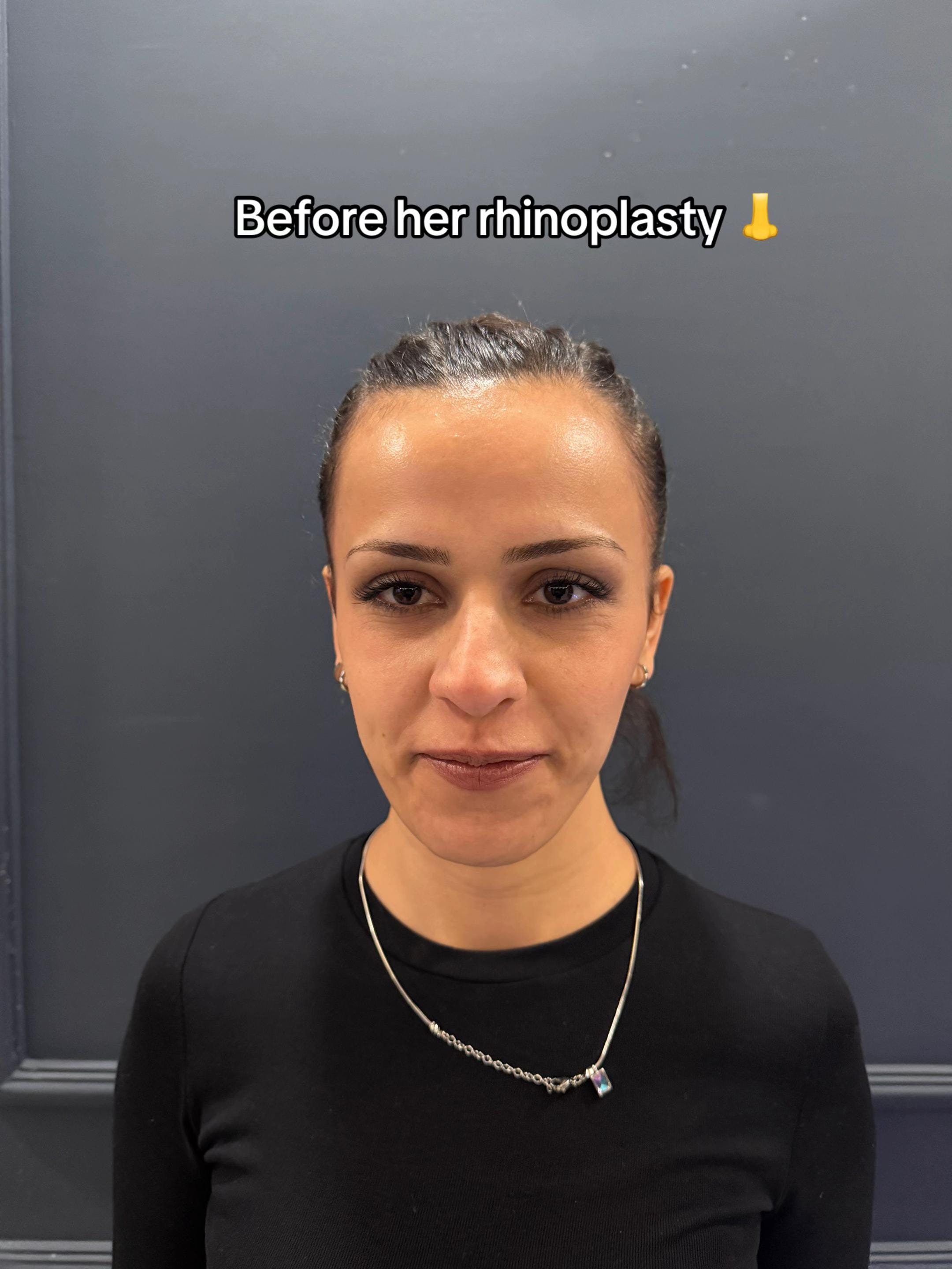 Post 10 by Dr Deniz Dilek on TikTok (video)