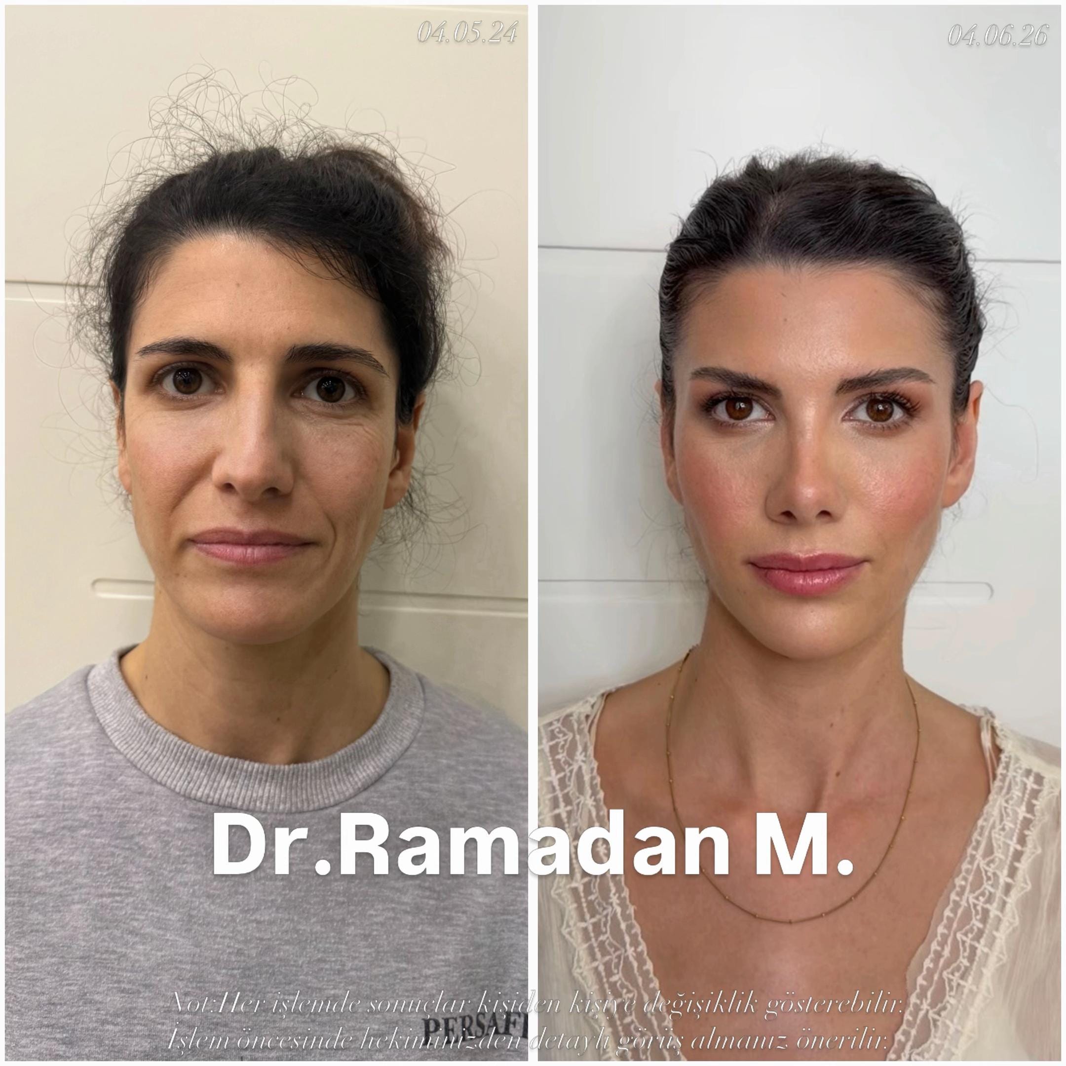 Post 7 by Dr.Ramadan.Mouemin.oglou on TikTok (video)