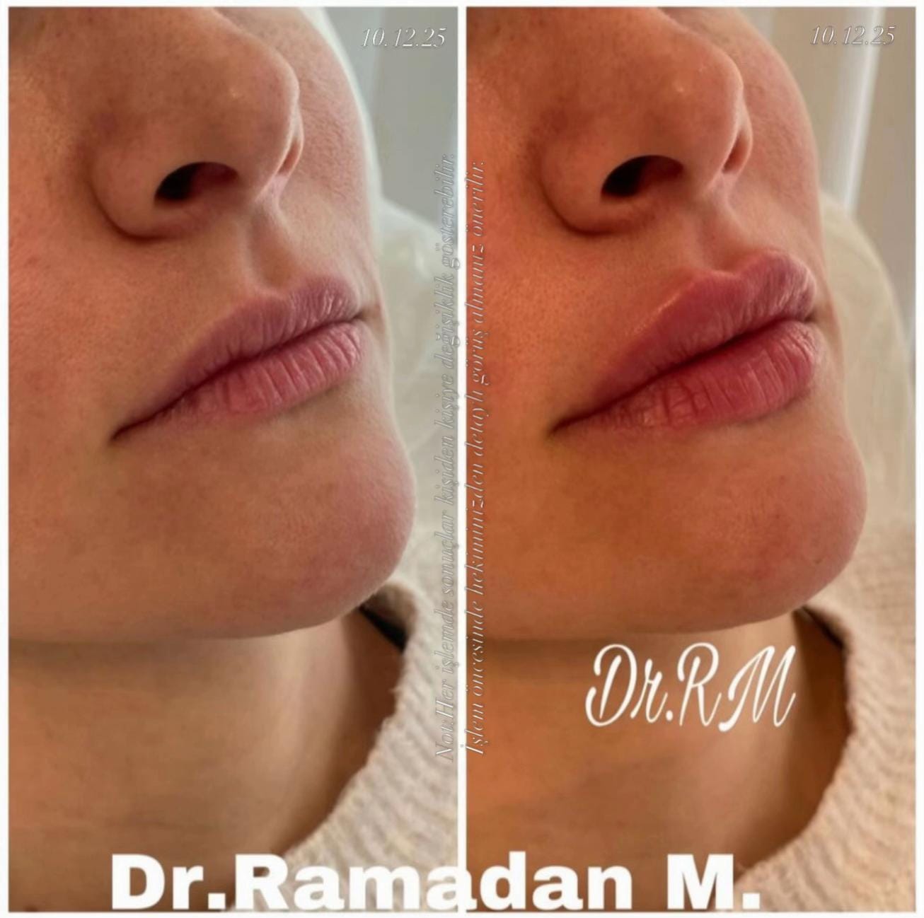 Post 4 by Dr.Ramadan.Mouemin.oglou on TikTok (video)