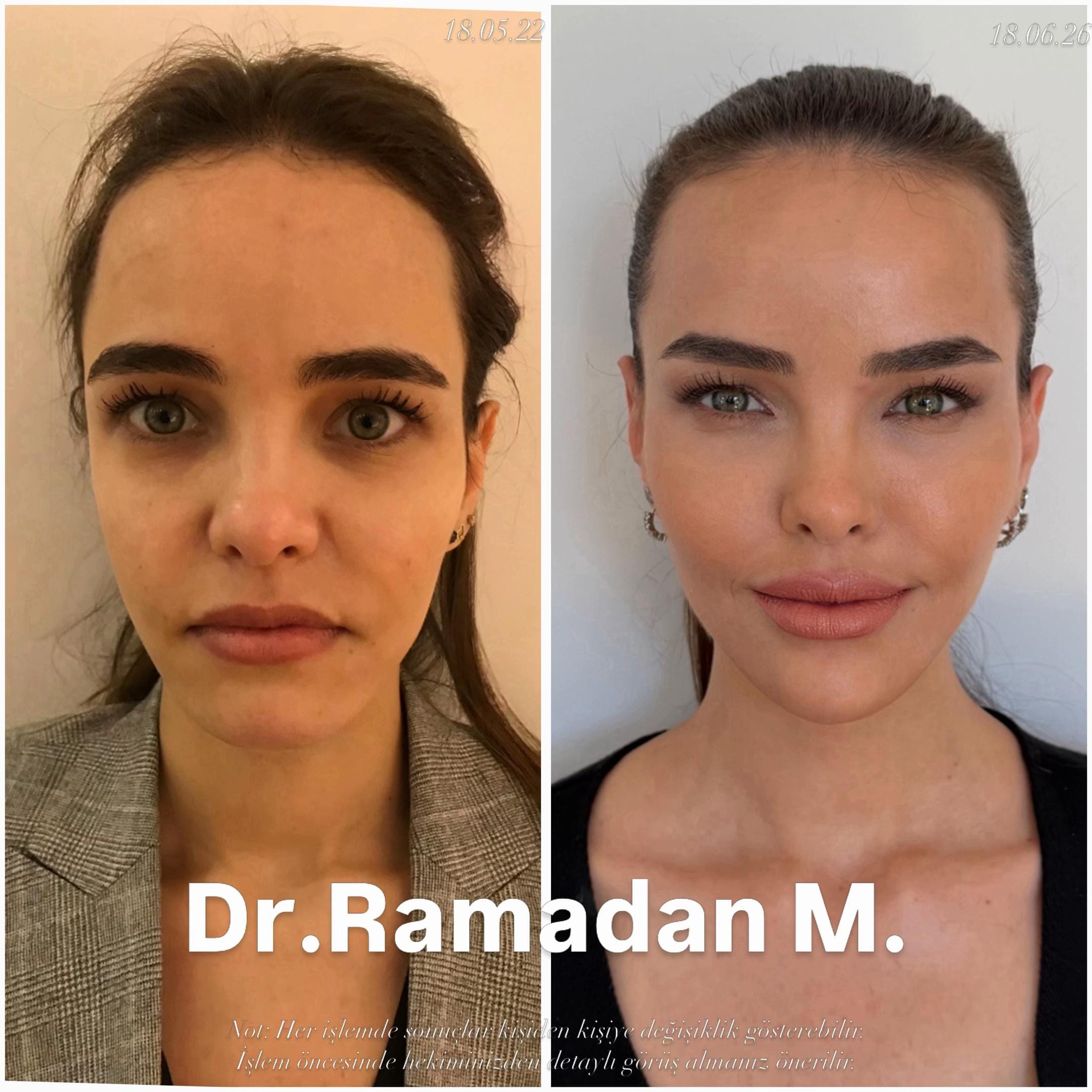Post 1 by Dr.Ramadan.Mouemin.oglou on TikTok (video)