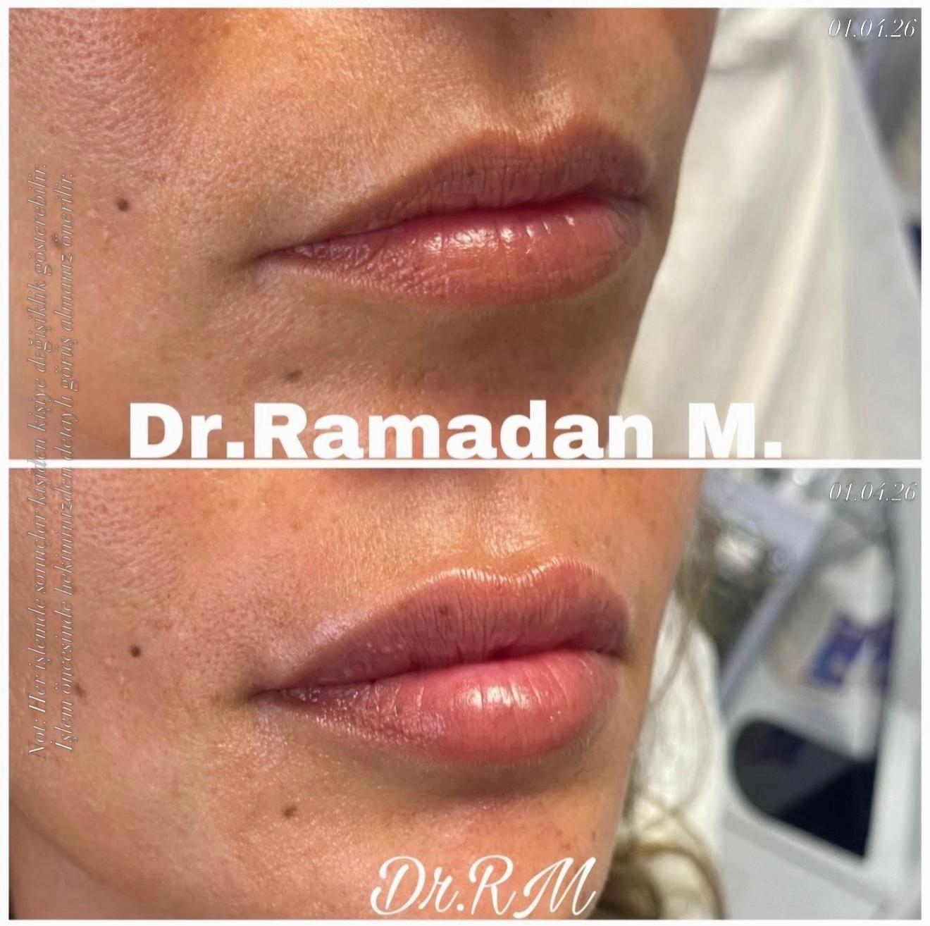 Post 10 by Dr.Ramadan.Mouemin.oglou on TikTok (video)