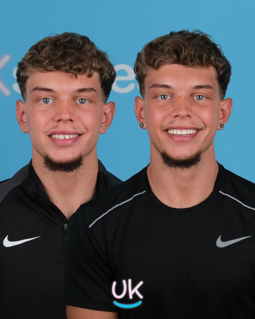 Post 9 by UK Smiles on TikTok (video)