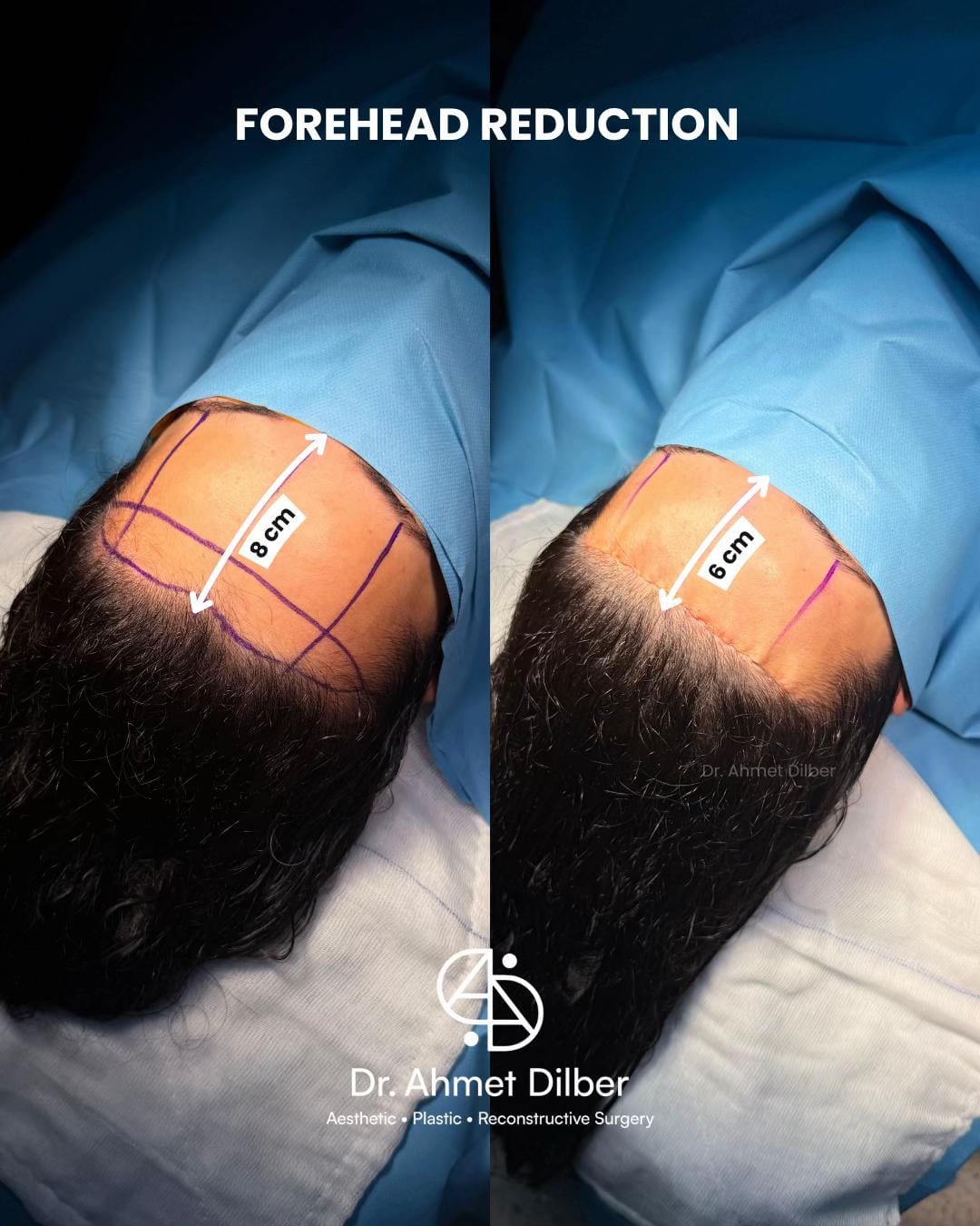 Post 8 by Dr. Ahmet Dilber on TikTok (video)