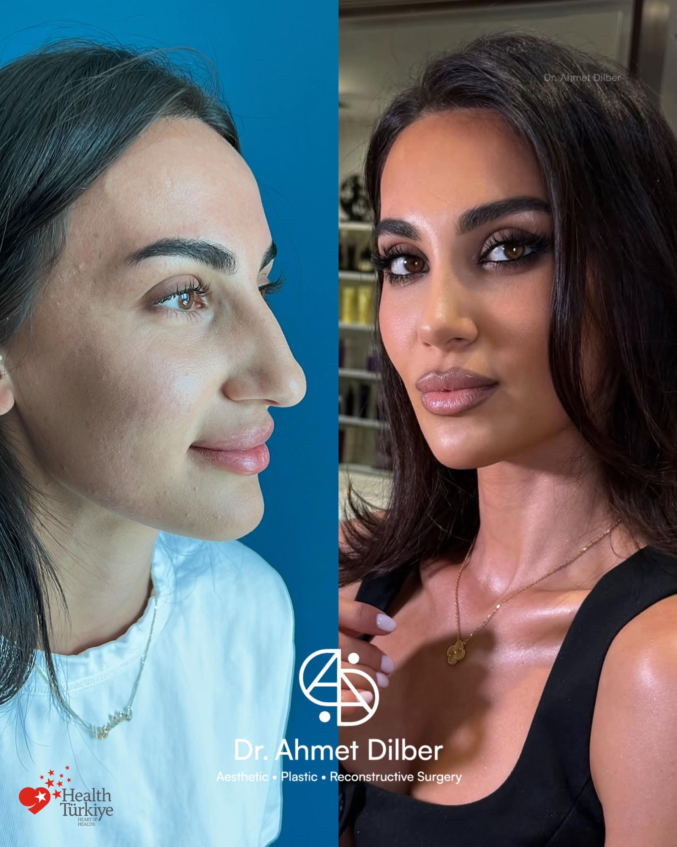 Post 4 by Dr. Ahmet Dilber on TikTok (video)