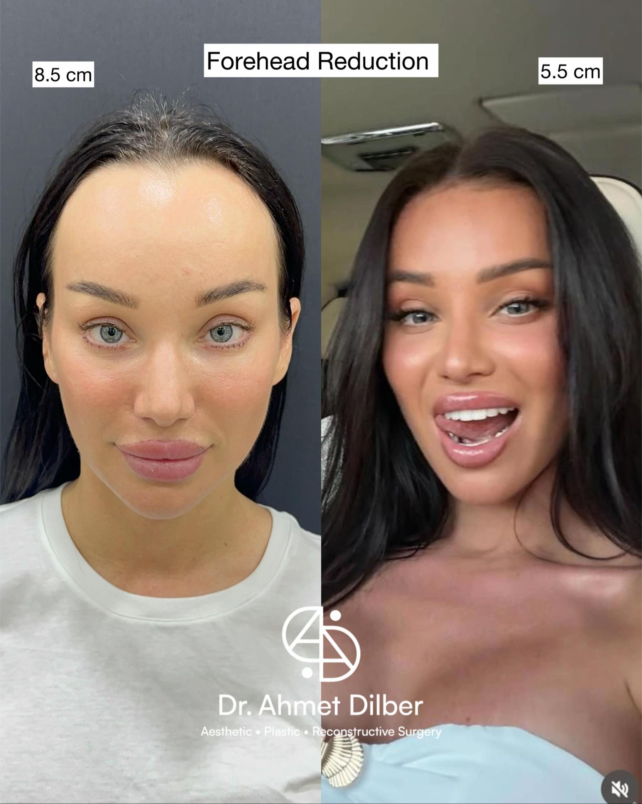 Post 10 by Dr. Ahmet Dilber on TikTok (video)