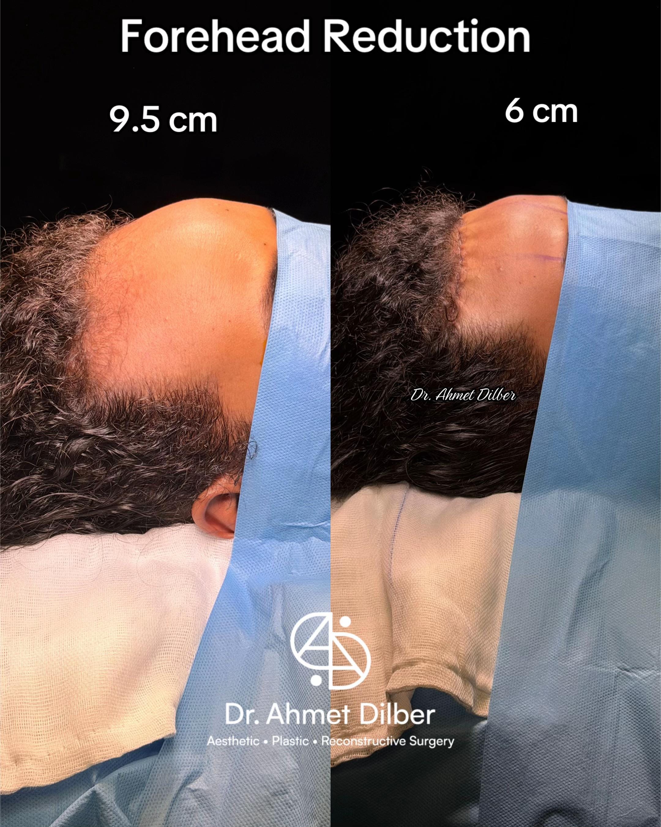 Post 3 by Dr. Ahmet Dilber on TikTok (video)