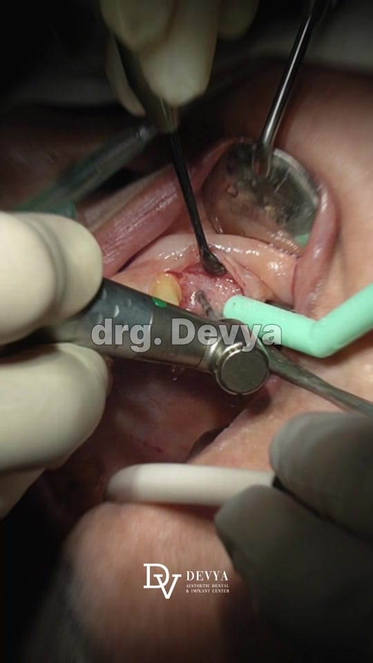 Post 2 by devyadentalclinic on TikTok (video)