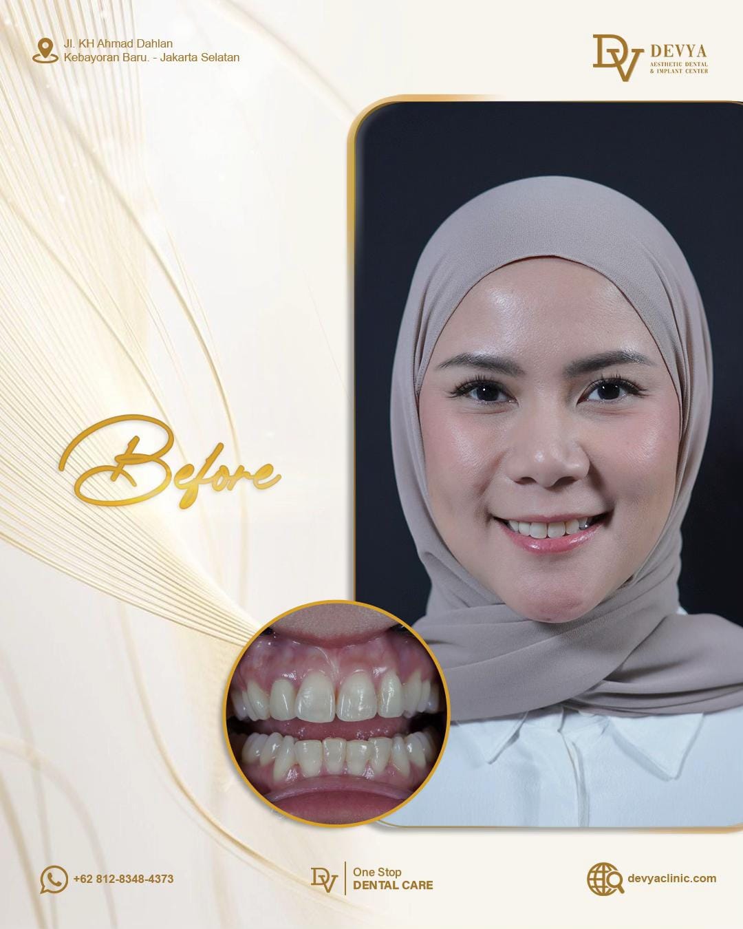 Post 1 by devyadentalclinic on TikTok (video)