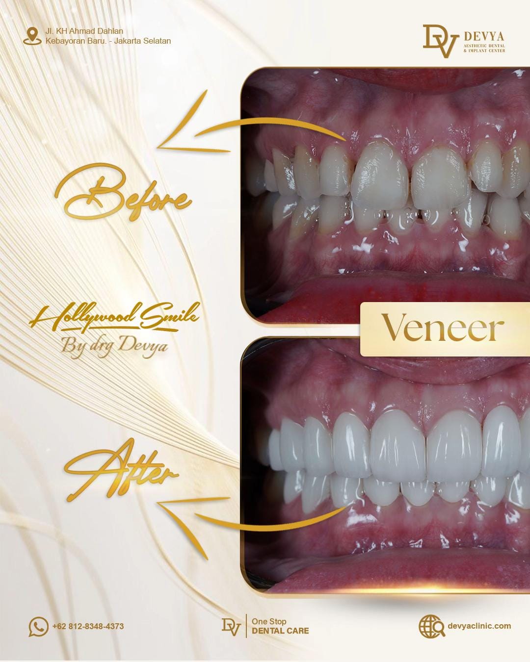 Post 6 by devyadentalclinic on TikTok (video)