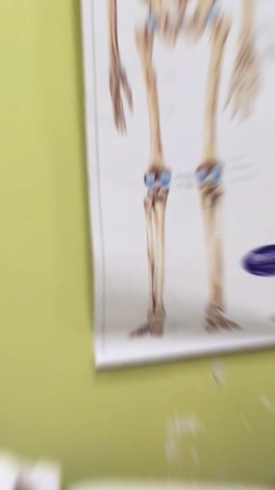 Post 9 by Bestcare Prosthetics on TikTok (video)