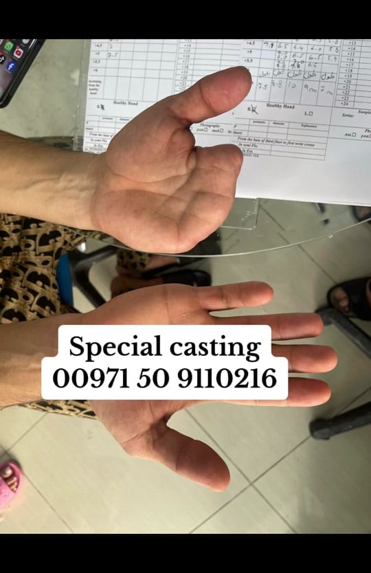 Post 8 by Bestcare Prosthetics on TikTok (video)