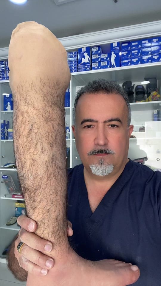 Post 10 by Bestcare Prosthetics on TikTok (video)