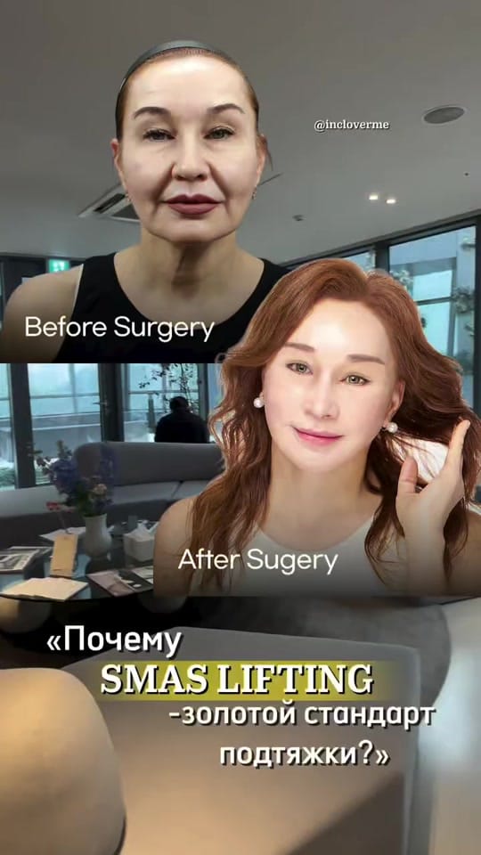 Post 9 by InCloverMe on TikTok (video)