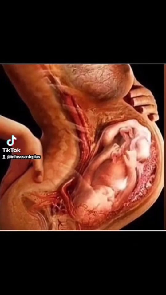 Post 3 by Nurse Rose 📚🩸🧠✍💊💉 on TikTok (video)