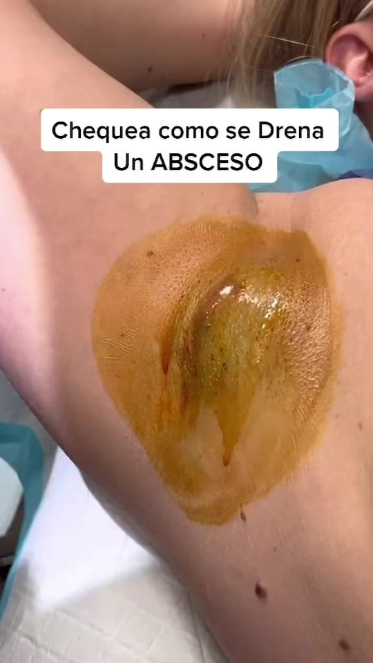 Post 9 by Dermatóloga Dra Ochy on TikTok (video)
