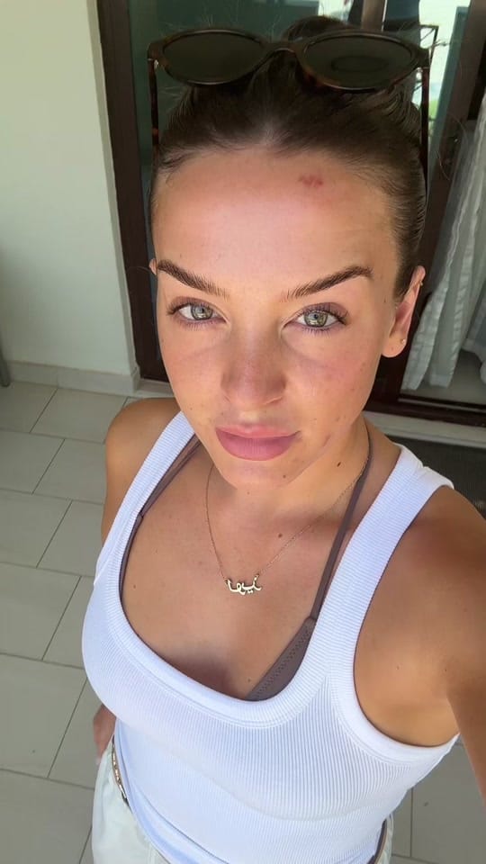 Post 10 by louisefraser on TikTok (video)
