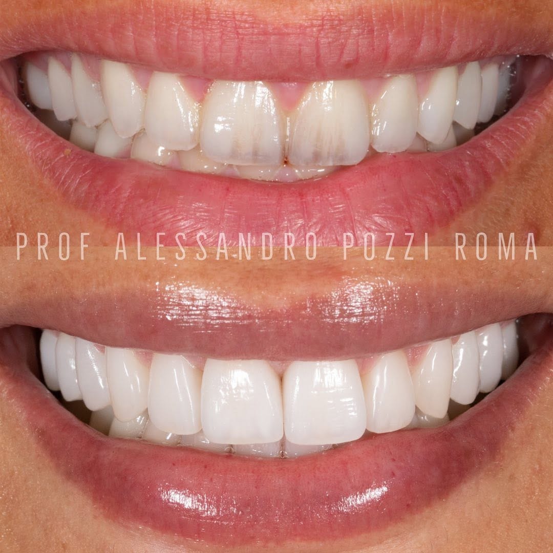 Post 10 by Alessandro Pozzi on Instagram (image)