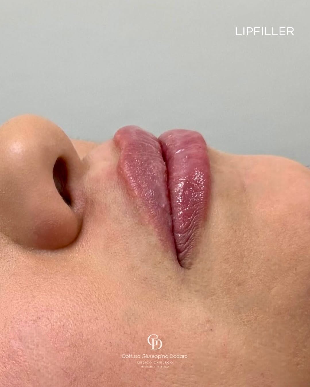 Post 9 by Dott.ssa Giuseppina Dodaro on Instagram (carousel)