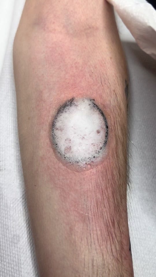 Post 7 by kinnoenvasetattoo on TikTok (video)