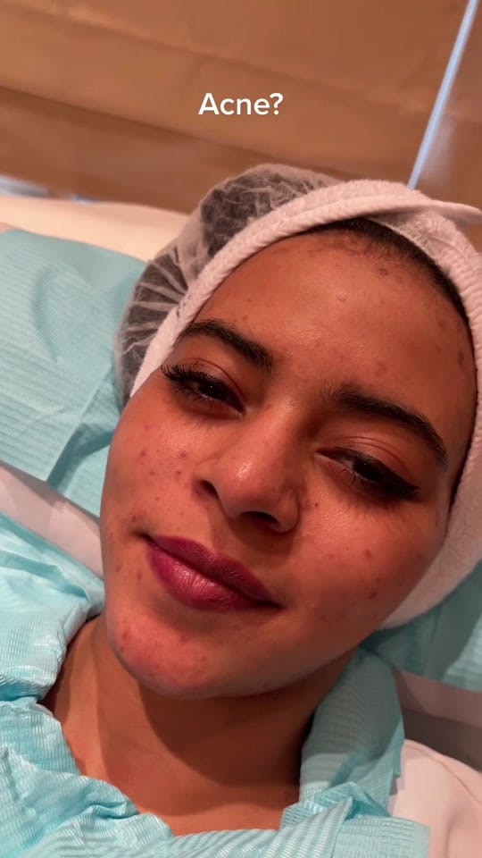 Post 10 by Doctor | Skin | Laser | Dubai on TikTok (video)