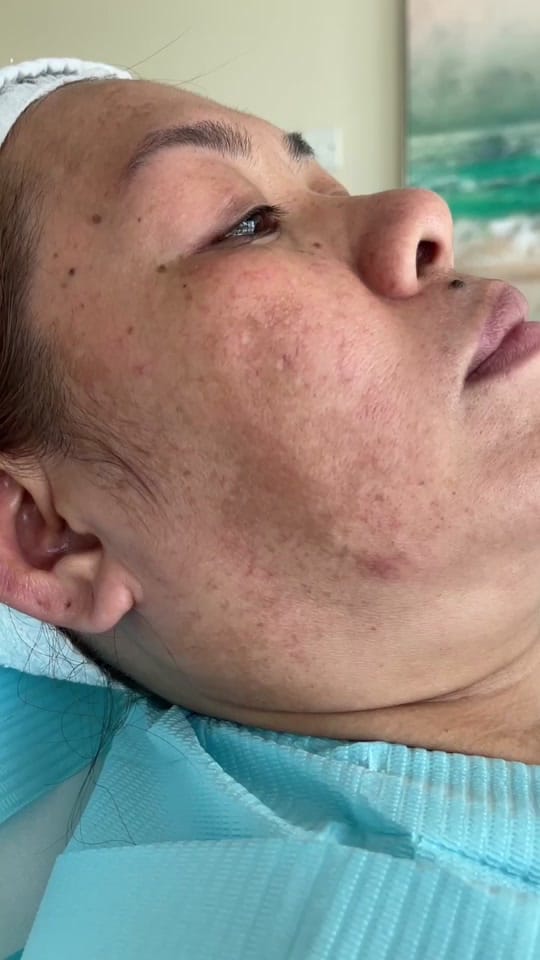 Post 9 by Doctor | Skin | Laser | Dubai on TikTok (video)