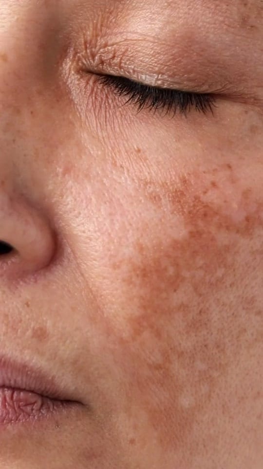 Post 2 by About.Skin on TikTok (video)