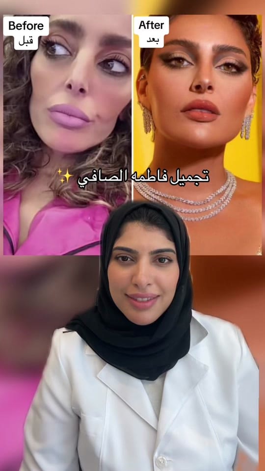 Post 10 by Dr. Randa Alnahary on TikTok (video)