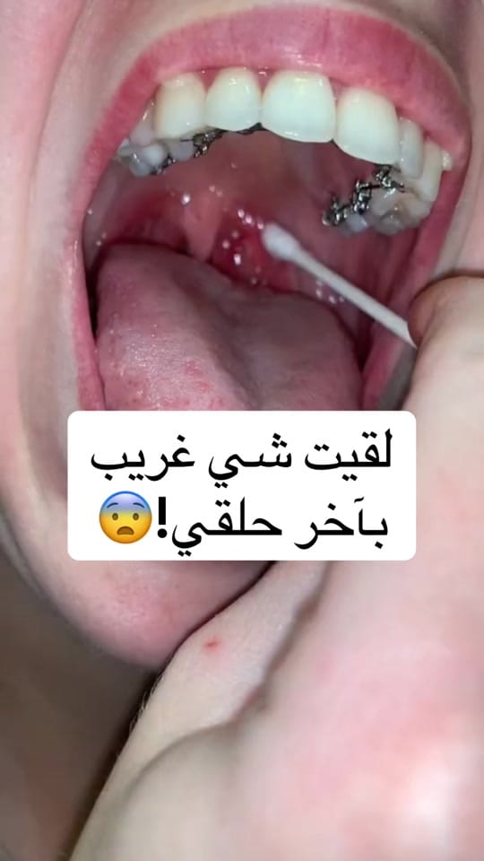 Post 8 by Dr.Mohammad Khalil on TikTok (video)