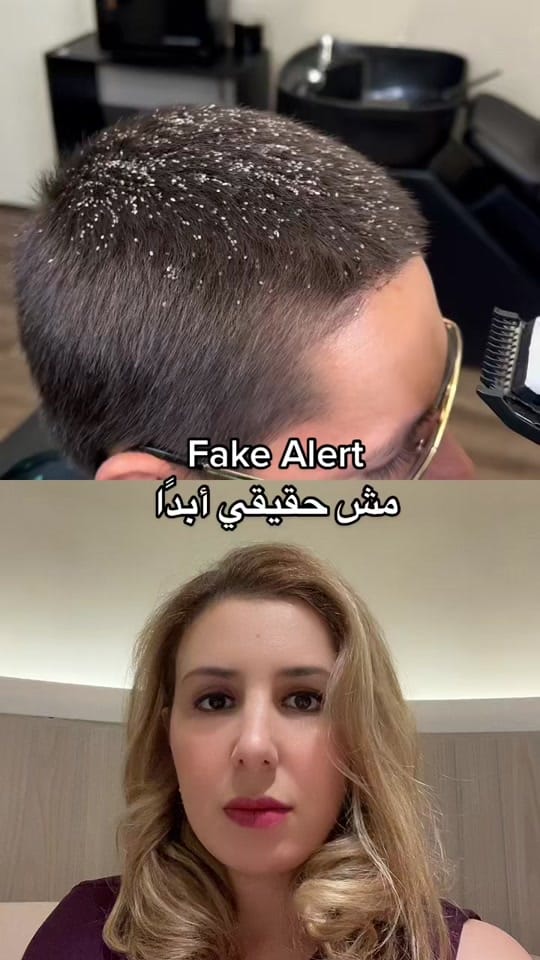 Post 9 by DermDoctor | Dr. Eissan on TikTok (video)