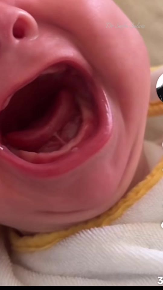 Post 3 by Dr Saifu Salam on TikTok (video)