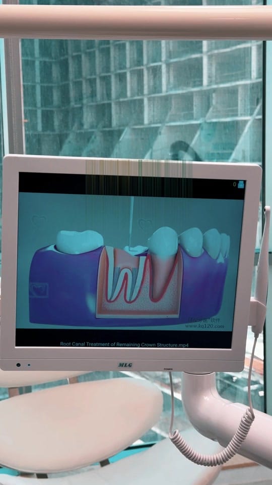 Post 8 by dentist_dubaiANAHIT on TikTok (video)