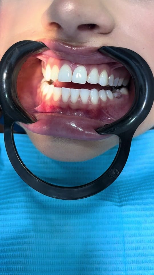 Post 1 by dentist_dubaiANAHIT on TikTok (video)