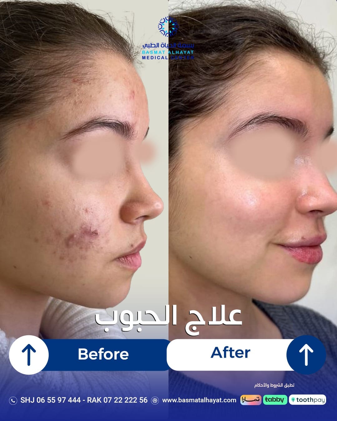 Post 8 by مركز بسمة الحياة الطبي on TikTok (video)
