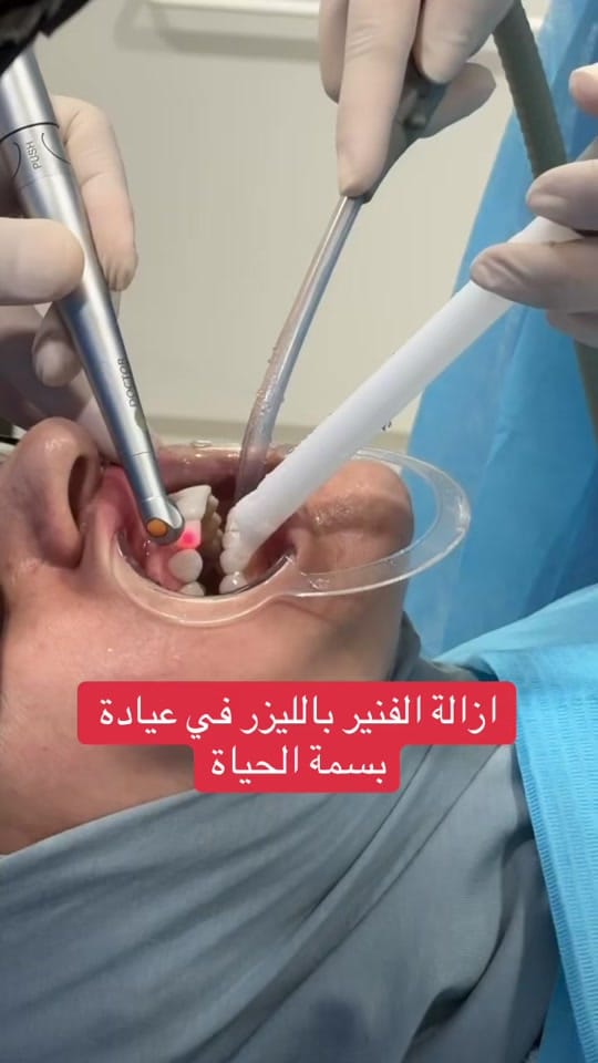 Post 1 by مركز بسمة الحياة الطبي on TikTok (video)