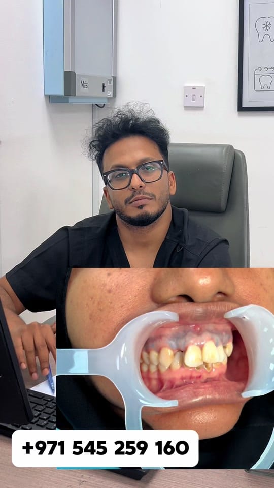 Post 4 by Dr ameen rashid on TikTok (video)