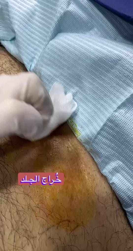 Post 10 by alnahrain medical center on TikTok (video)