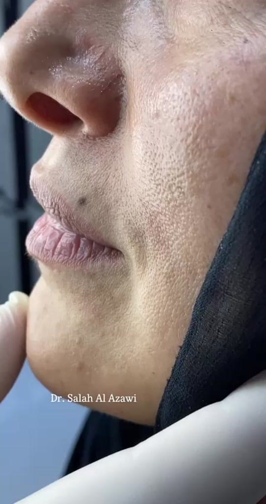 Post 9 by alnahrain medical center on TikTok (video)