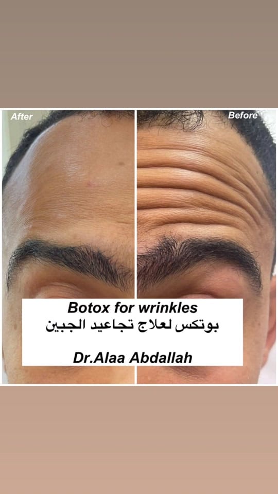 Post 10 by Dr.alaa abdallah on TikTok (video)