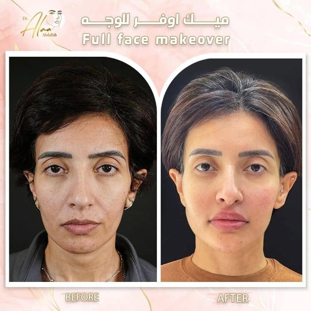 Post 8 by Dr.alaa abdallah on TikTok (video)