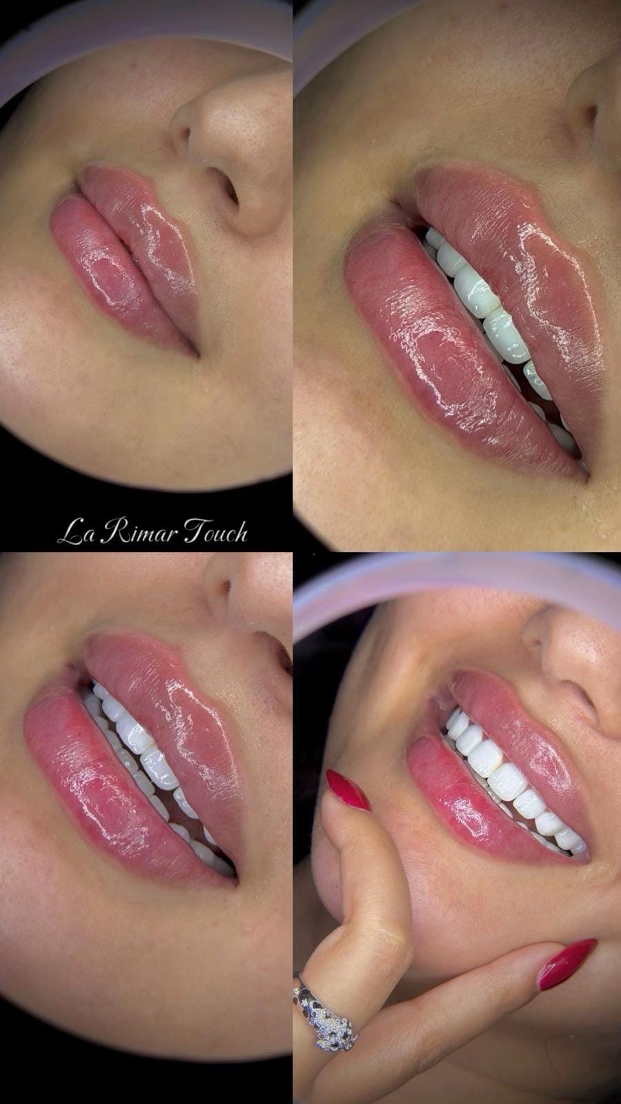 Post 3 by La Rimar Clinic on TikTok (video)