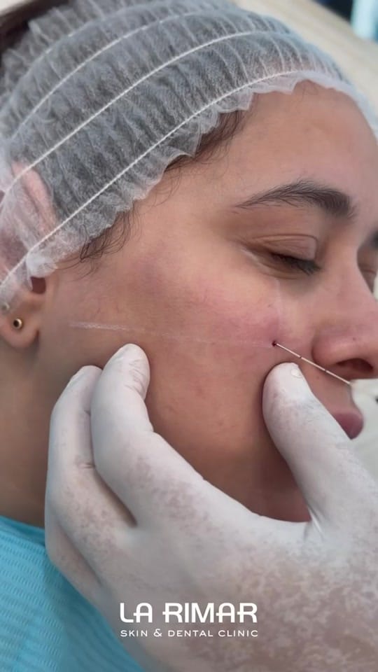 Post 1 by La Rimar Clinic on TikTok (video)