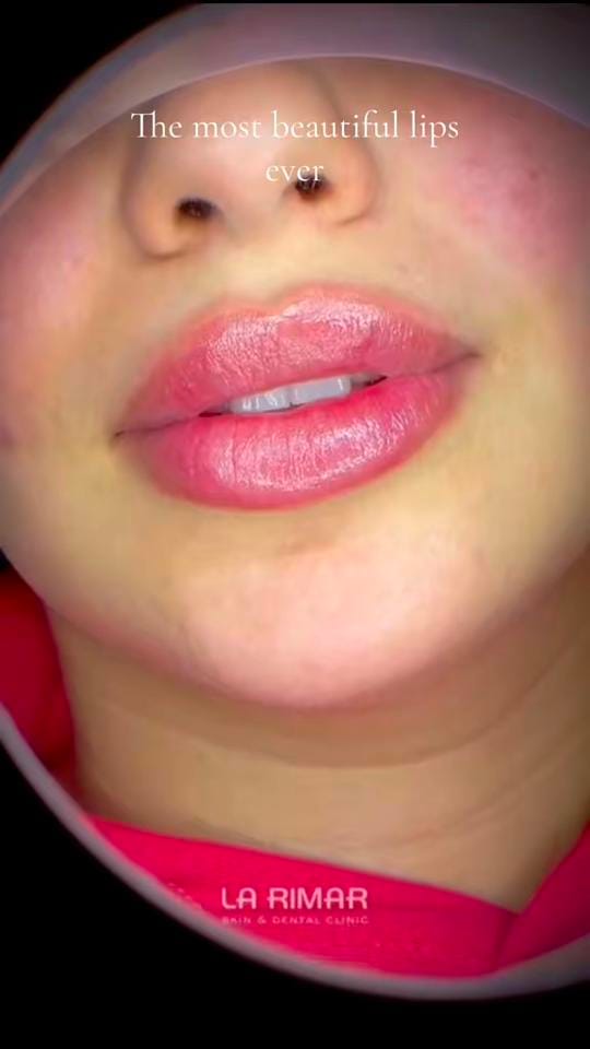 Post 4 by La Rimar Clinic on TikTok (video)