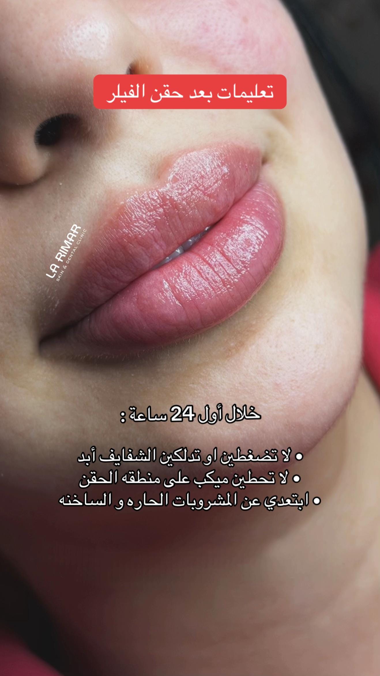 Post 10 by La Rimar Clinic on TikTok (video)