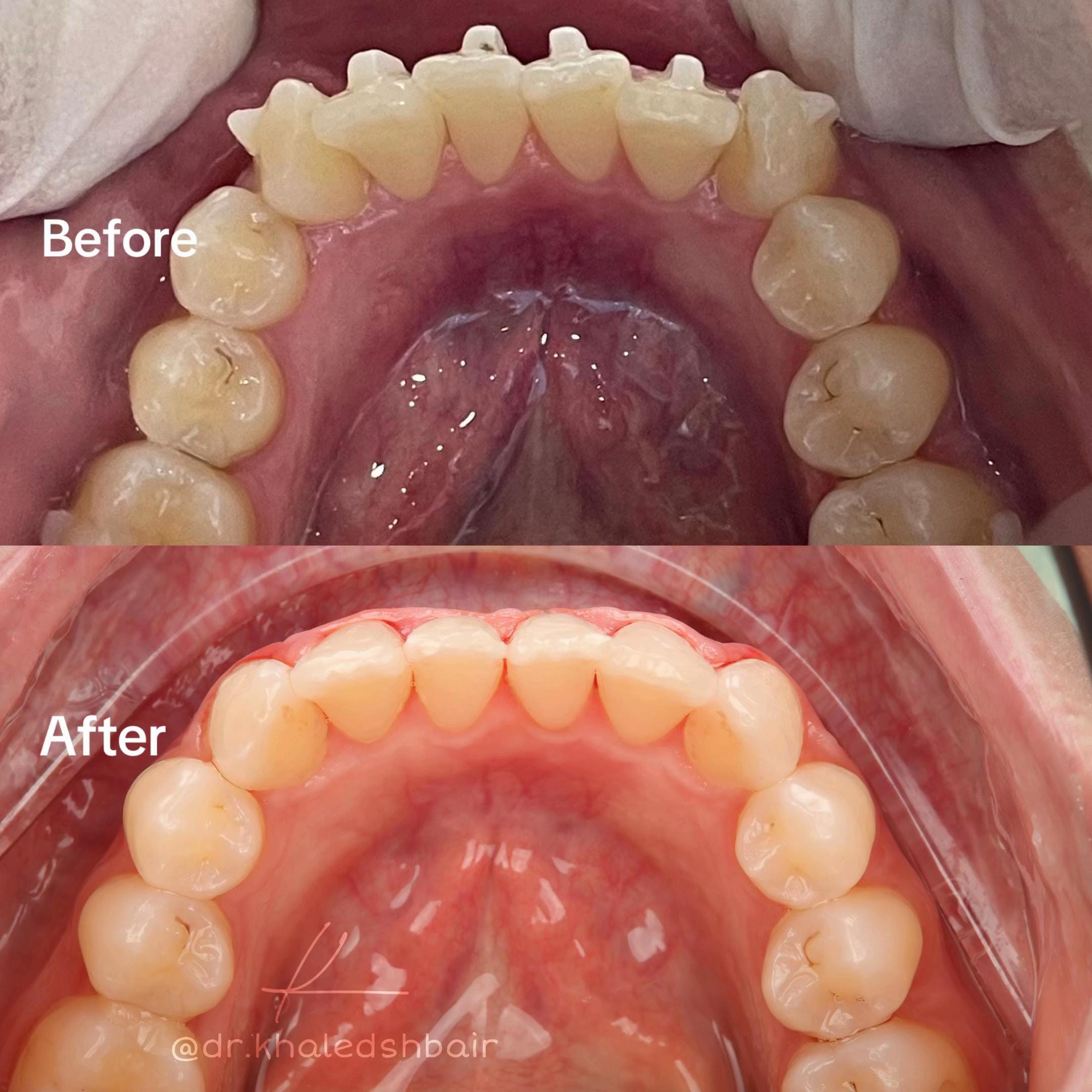 Post 7 by Dentist.khaled | Dubai Dentist on TikTok (video)