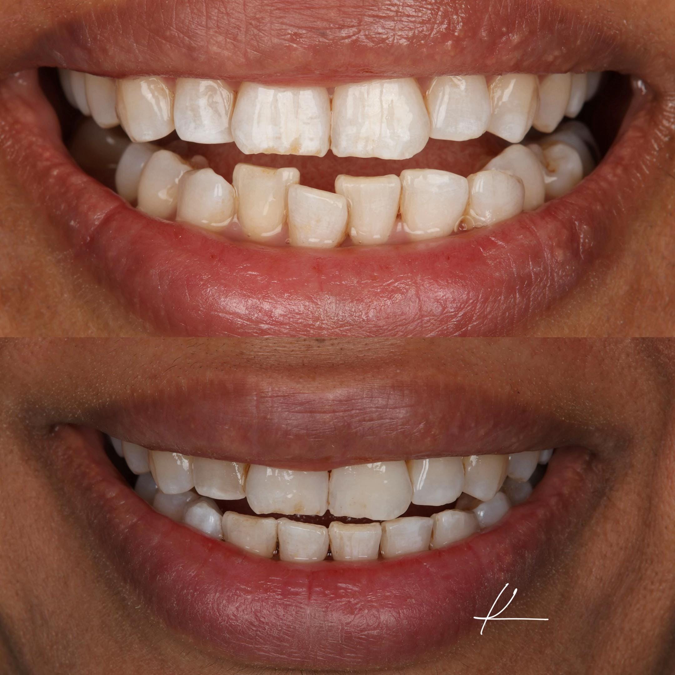 Post 1 by Dentist.khaled | Dubai Dentist on TikTok (video)