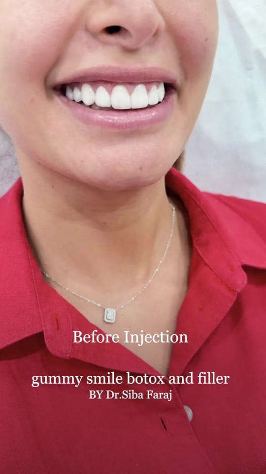Post 7 by Dr.sibafaraj on TikTok (video)