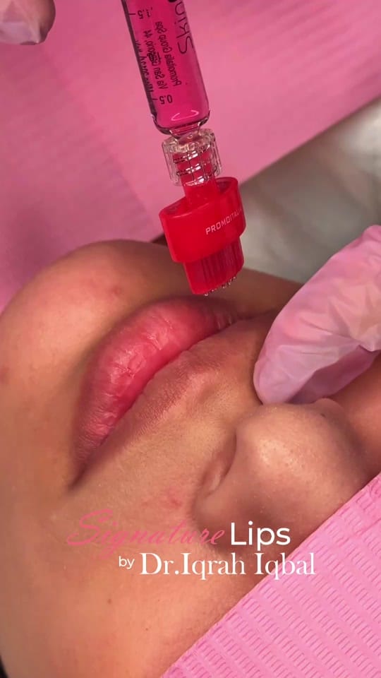 Post 8 by Dr.Iqrah.Aesthetics on TikTok (video)